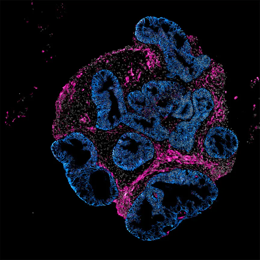 Microscopic view of lab-grown human intestinal tissue samples in a research laboratory environment